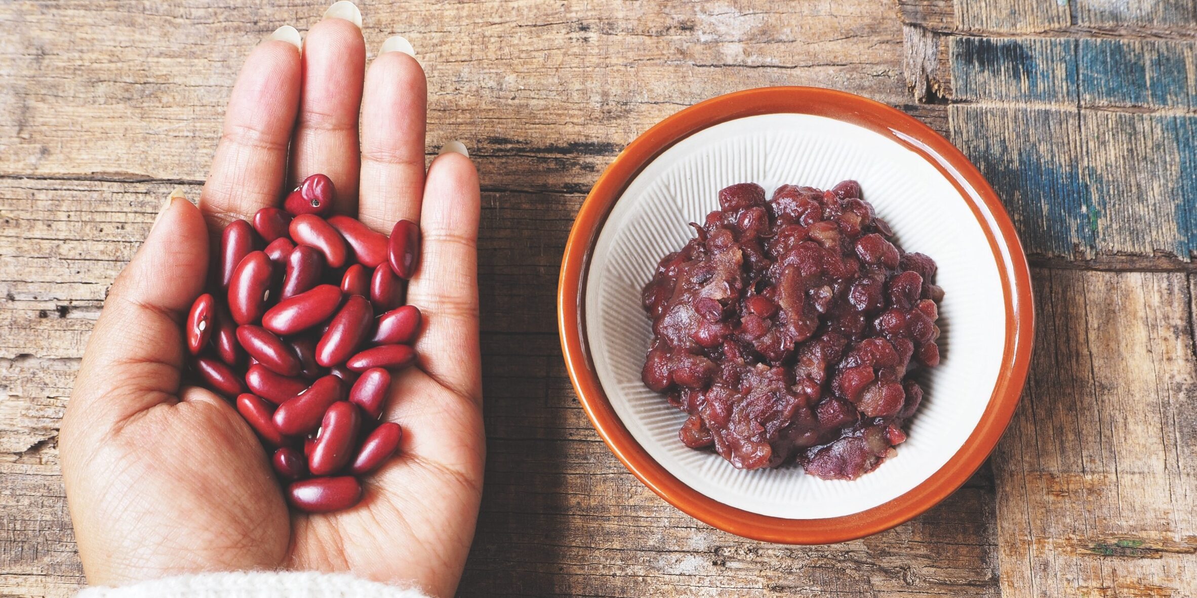 Adzuki beans 7 31 2023 123RF